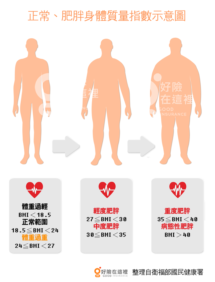 縮胃手術為減重 醫療險 失能險理賠報你知 Goodins好險在這裡